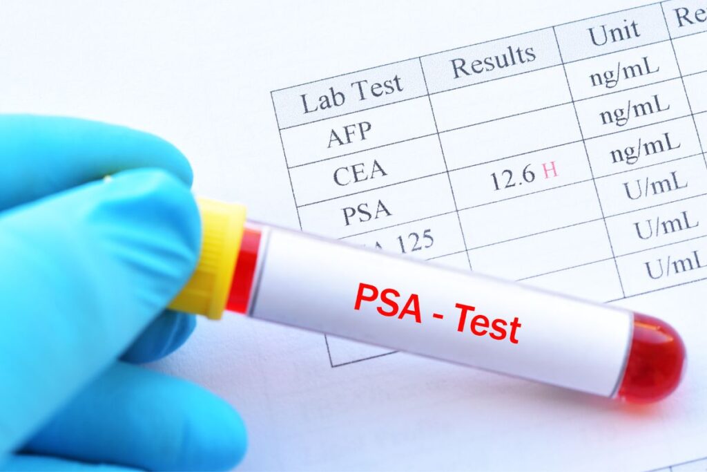 Exame do PSA: Entenda sua importância, preparo e interpretação dos resultados