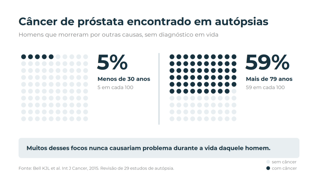 Câncer de próstata encontrado em autópsias: cerca de 5% dos homens com menos de 30 anos e cerca de 59% dos homens com mais de 79 anos