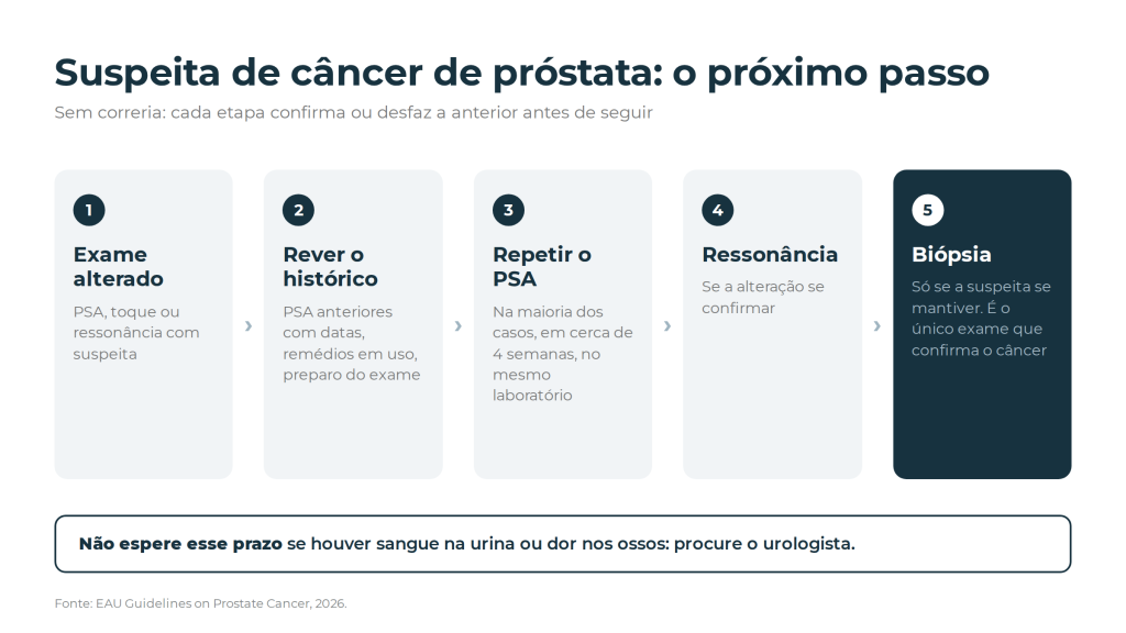 O próximo passo diante de uma suspeita de câncer de próstata: exame alterado, rever o histórico, repetir o PSA, ressonância e, só se a suspeita se mantiver, biópsia