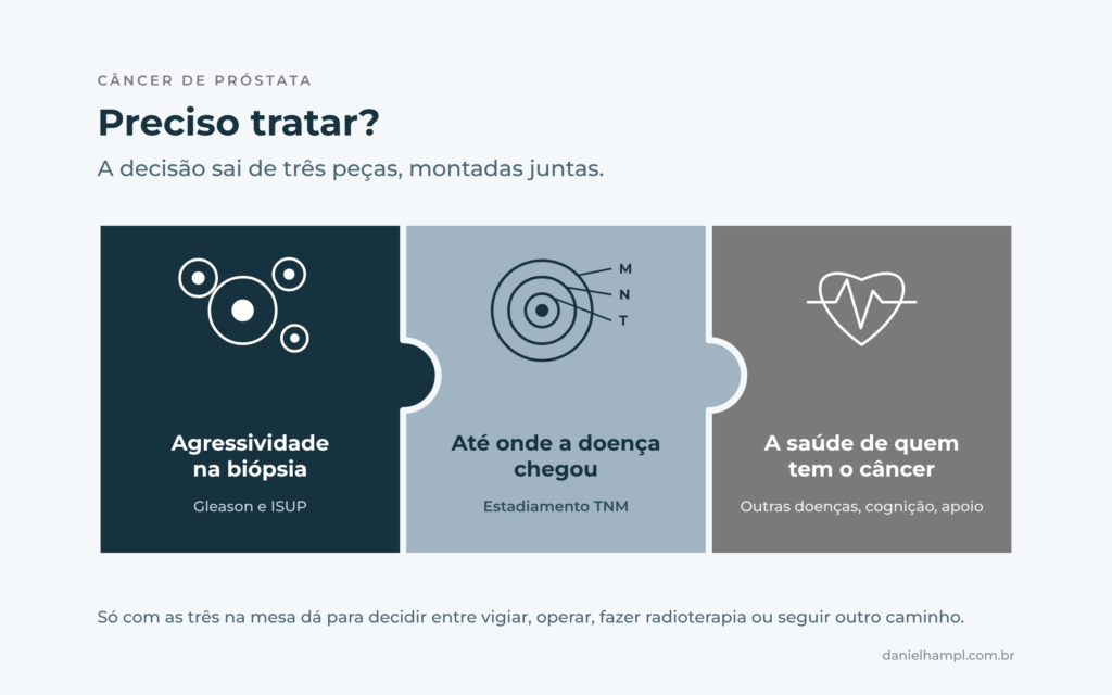 As três peças da decisão de tratar câncer de próstata: a agressividade na biópsia, o estadiamento e a saúde do paciente