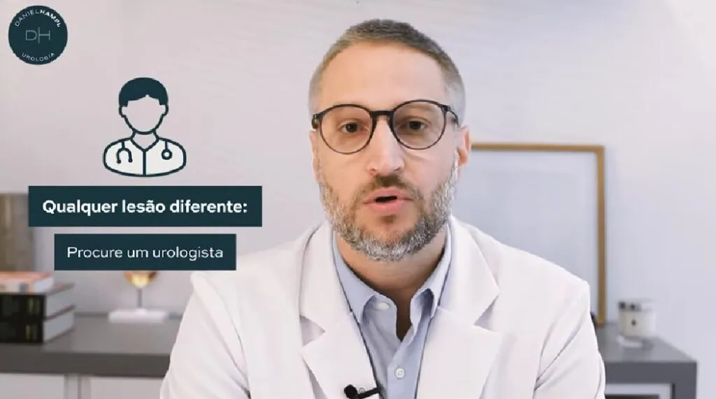 Como Aparece o Câncer de Pênis?