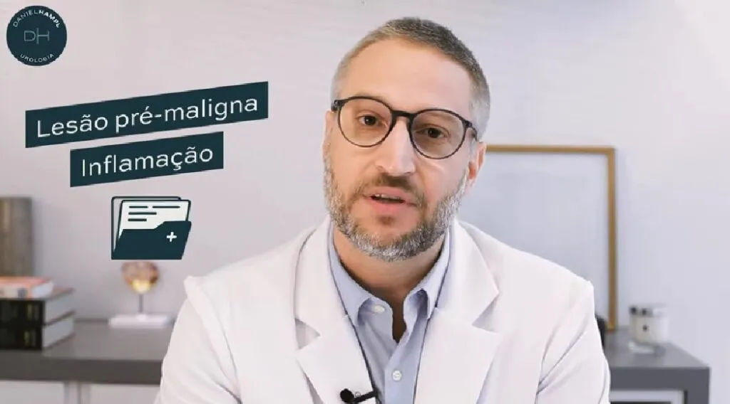 Como Aparece o Câncer de Pênis?