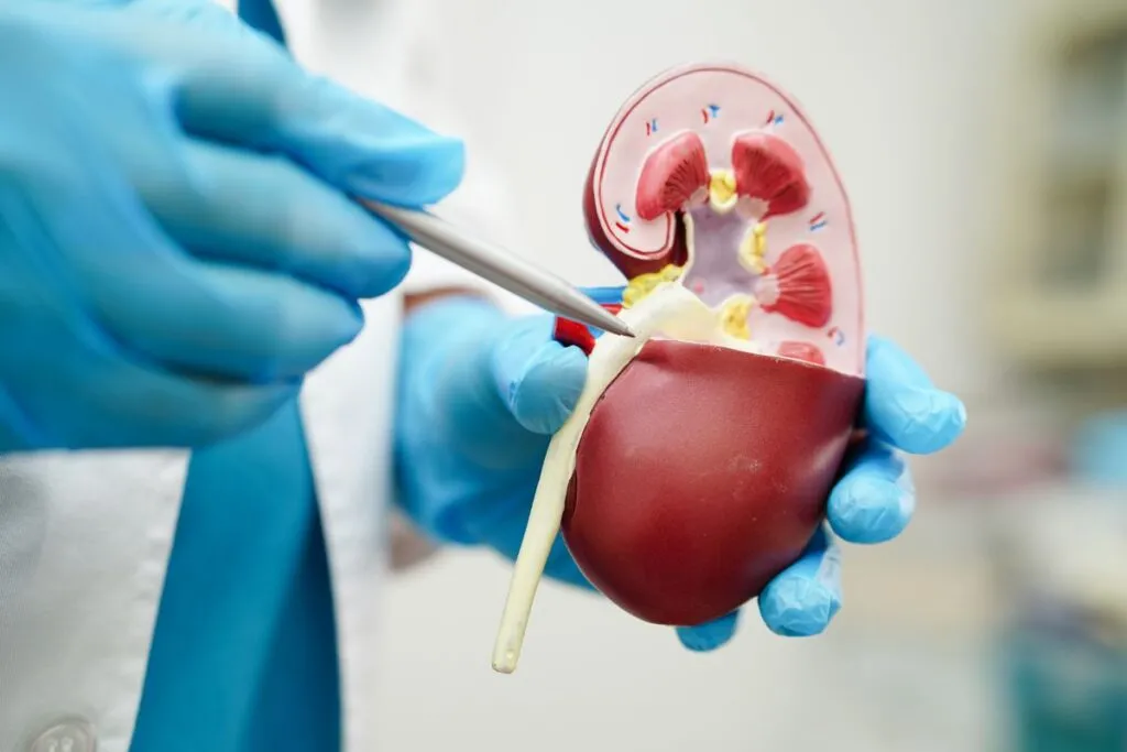 Cirurgia de pedra nos rins: Litotripsia
