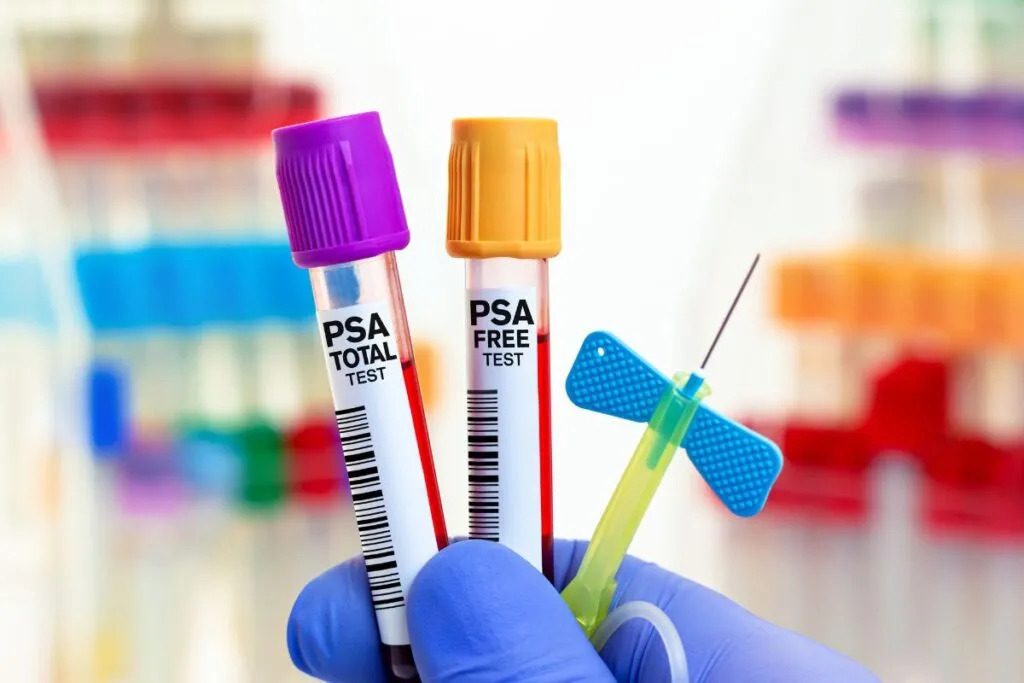 PSA total e livre: entenda as diferenças e por que isso muda o diagnóstico da próstata